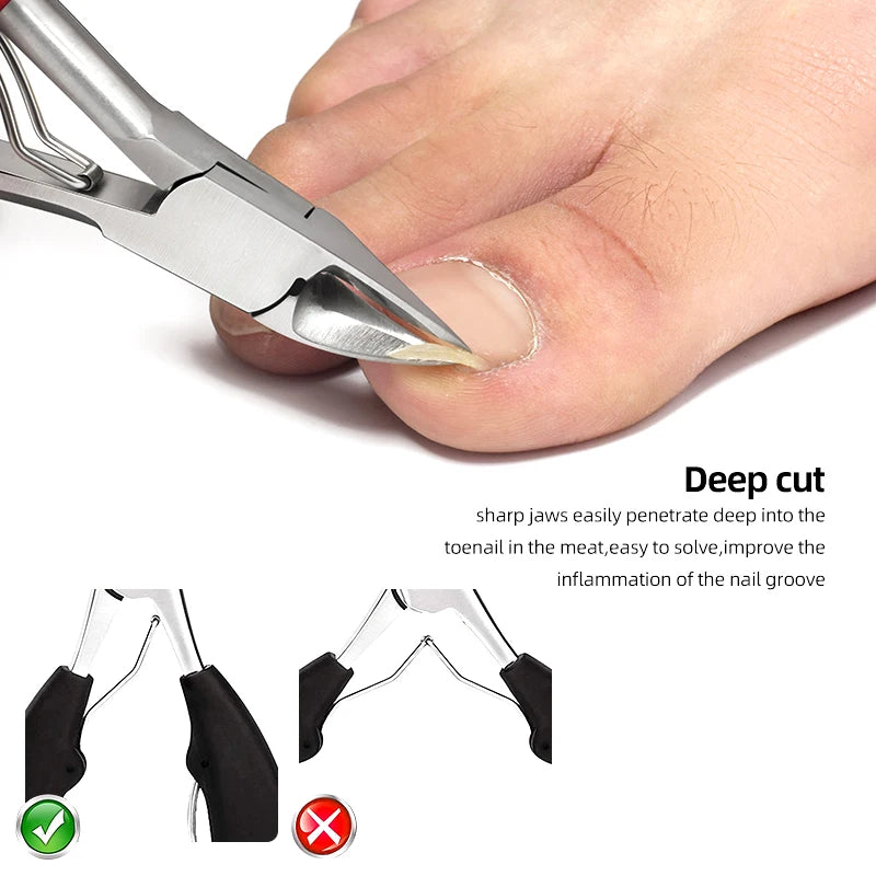 Stainless Steel Toenail Nippers Pointed Straight with Plastic Handle