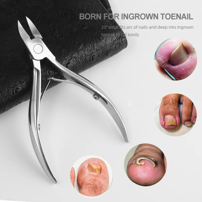 Stainless Steel Ingrown Toenail Nippersr Straight Pointed